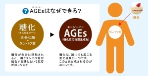 AGEs-1